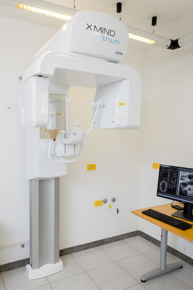 Tac 3D, immagine radiologica orale digitale e tridimensionale